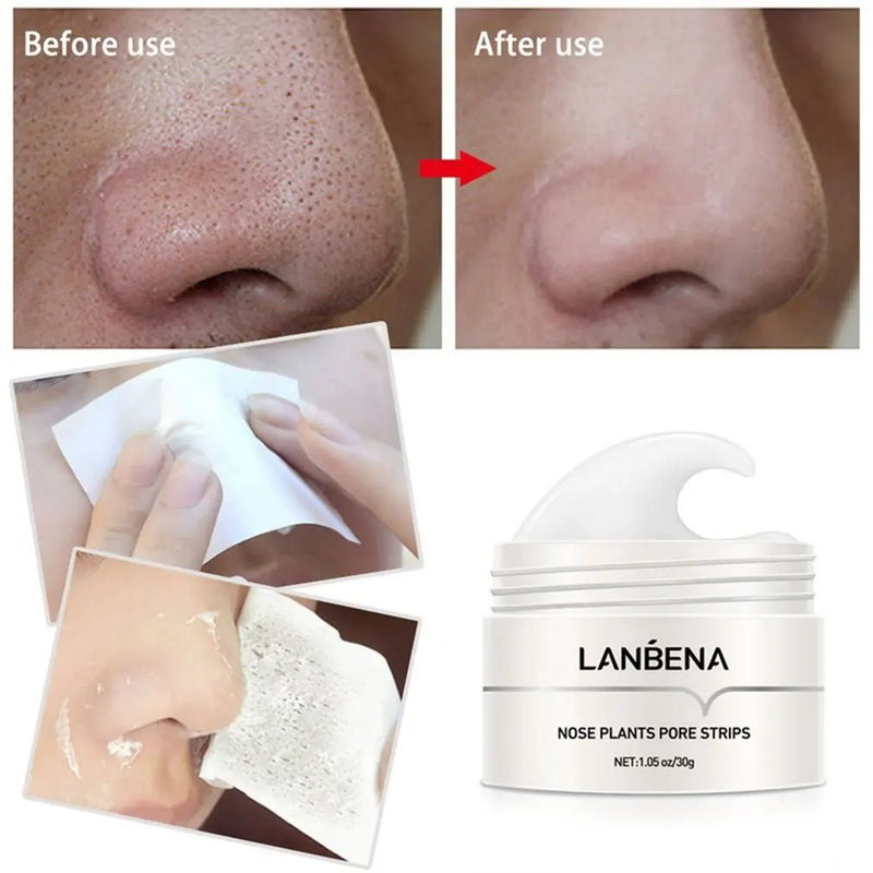 Remover Facial de cravos sem dor  LANBENA